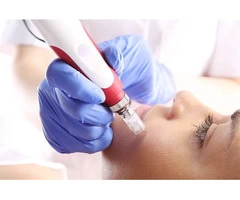 Best Epsom Skin Clinic