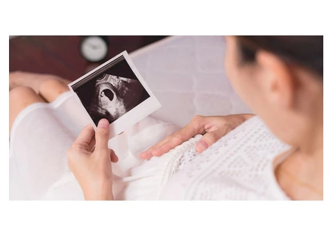 Discover the Wonders of Your Pregnancy: 8 Week Ultrasound Guide