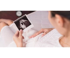 Discover the Wonders of Your Pregnancy: 8 Week Ultrasound Guide