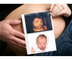 Avail 4D Baby Scan Service At Window To The Womb Cardiff