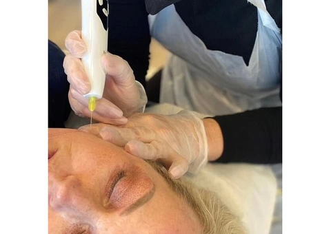 Laser Skin Tightening Stomach in Chester