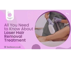 All You Need to Know About Laser Hair Removal Treatment
