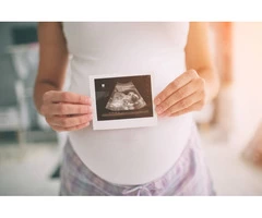 Get an Accurate Fetal Well Being Scan At Peterborough