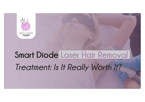 Smart Diode Laser Hair Removal Treatment: Is Really Worth It?