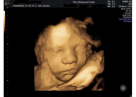 Step into the world of 4D baby scanning at Window to the Womb, Hitchin.