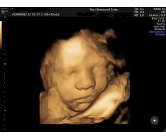 Step into the world of 4D baby scanning at Window to the Womb, Hitchin.