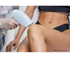 So, you’re looking Into Getting Laser Hair Removal?
