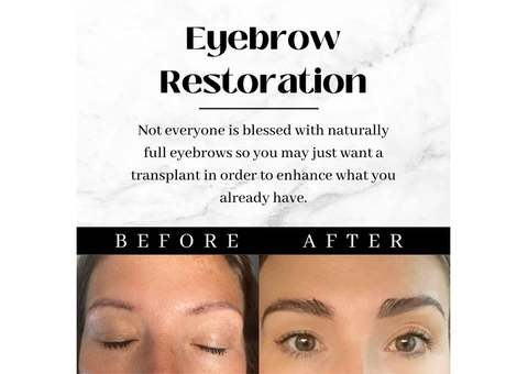 What Is Eyebrow Restoration Surgery?