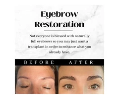 What Is Eyebrow Restoration Surgery?