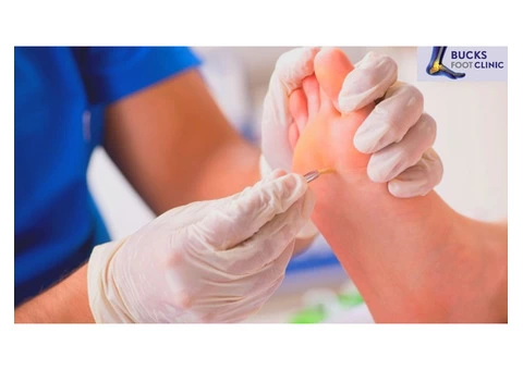 Foot Corn Treatment & Callus Removal for the Elderly
