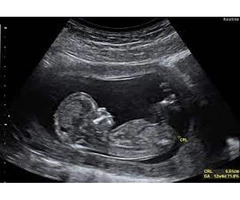 Monitor your baby's growth and development with Growth Scan Clinic at hitchin.