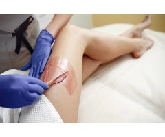 The Magic of Laser Hair Removal | Say Goodbye to Unwanted Hair