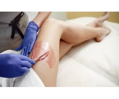 The Magic of Laser Hair Removal Say Goodbye to Unwanted Hair