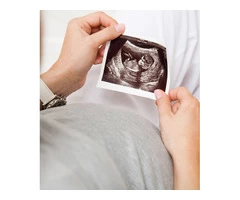 Get A Fetal Well Being Scan From Window To The Womb In Cardiff