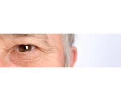 Suffering From Eyelid Papilloma? Contact Dr Pari Shams For Better Treatment