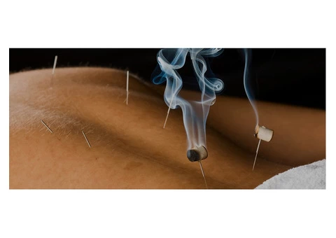 Experience Healing with Julia Exposito - Acupuncture Treatment for Depression