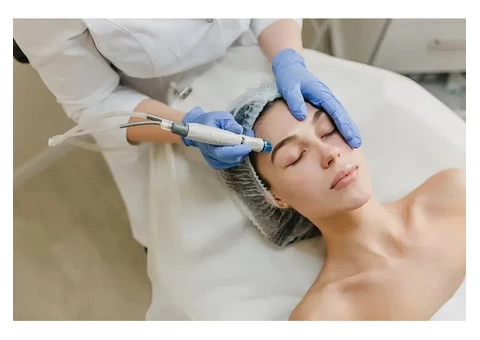 Advanced Laser Hair Removal in Harrow