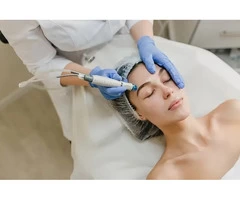 Advanced Laser Hair Removal in Harrow