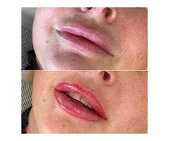 Semi Permanent Lip Liner in Chester