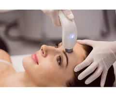 The Ultimate Guide to Laser Hair Removal Treatment in Harrow