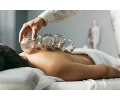 Cupping for Beginners: How to Get Started with Cupping Therapy