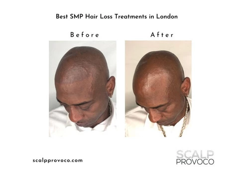 Scalp Provoco - 2/7