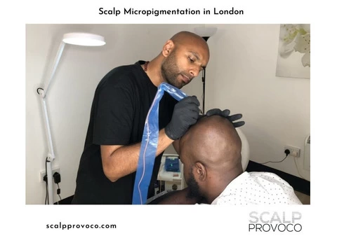 Scalp Provoco - 5/7