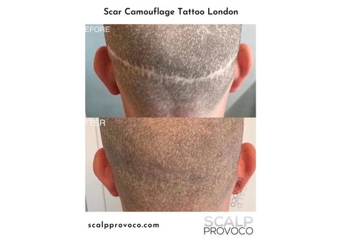 Scalp Provoco - 7/7