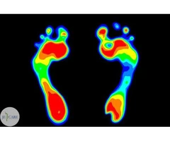 Go for Foot Analysis and find out about your gait