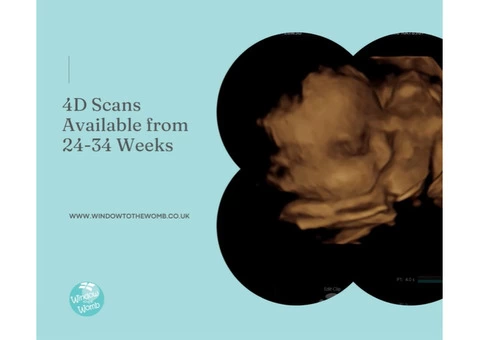 We Offer The Best 4D Baby Scanning in Cambridge