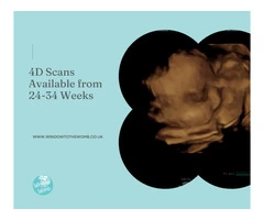 We Offer The Best 4D Baby Scanning in Cambridge
