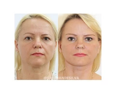 The Centre for Advanced Facial Cosmetic and Plastic Surgery: Dr Julian de Silva