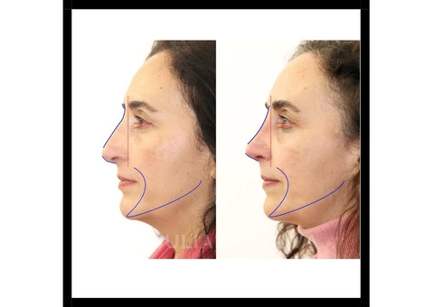 The Centre for Advanced Facial Cosmetic and Plastic Surgery: Dr Julian de Silva - 4/5