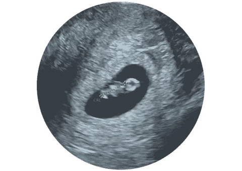 Experience Peace of Mind with Window to the Womb Aylesbury's Reassurance Scan!