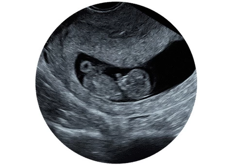 Experience the wonder of pregnancy with Window to the Womb Hitchin's Growth Scan Clinic.
