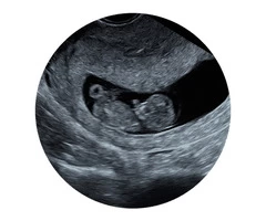 Experience the wonder of pregnancy with Window to the Womb Hitchin's Growth Scan Clinic.