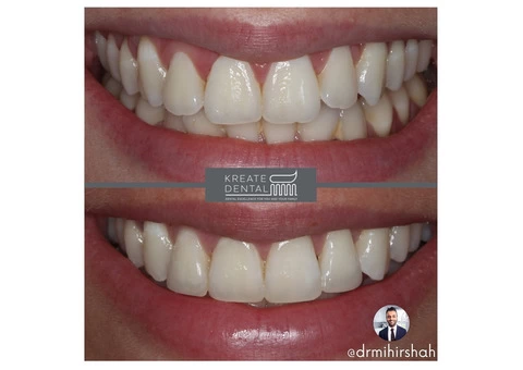 Kreate Dental Dartford - 7/7