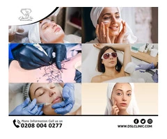 Capillaries Treatment London