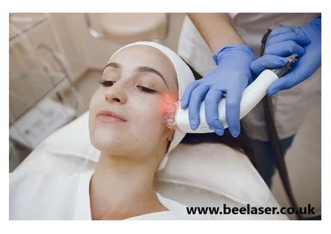 Mastering Hair Removal Techniques in Harrow A Complete Guide