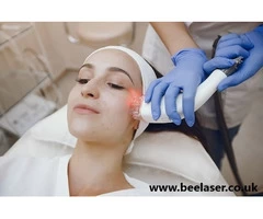 Mastering Hair Removal Techniques in Harrow A Complete Guide