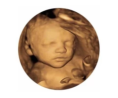 Experience the magic of pregnancy with Window to the Womb Watford.