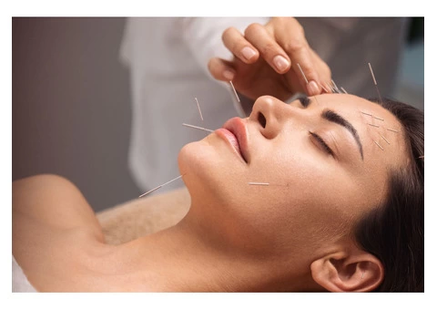 Increase the quality of health with London Acupuncture