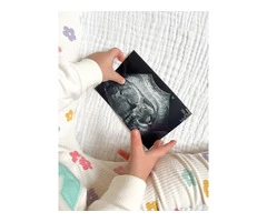 Discover Your Baby's Gender! Private Clinic In Cardiff