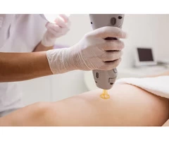 Achieving Effortless Elegance | Full Body Hair Removal Treatment in Harrow