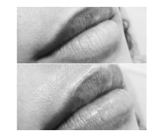 Cosmetic Treatments
