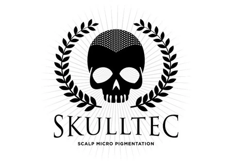 Scalp Micropigmentation in Scotland