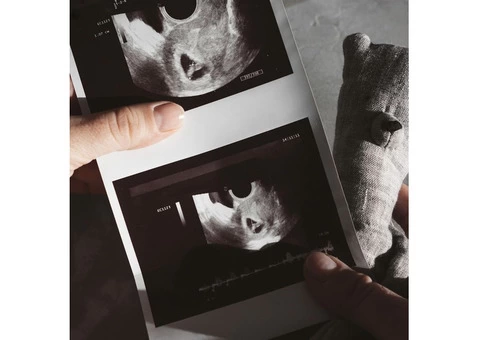 Well-being Scan Clinic In Watford- Book Your Appointment Today!