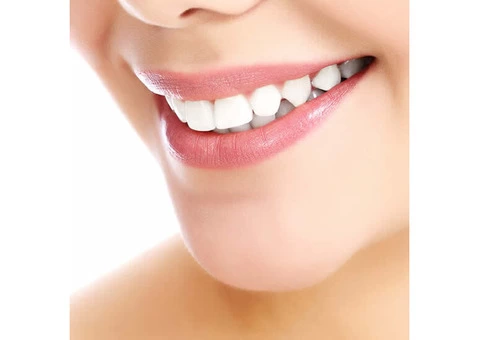 Smile Makeovers For A New You