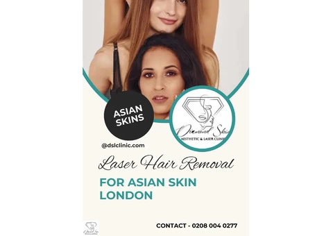 Laser Hair Removal for Asian Skin London