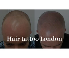 Hair Tattoo For Men in The UK